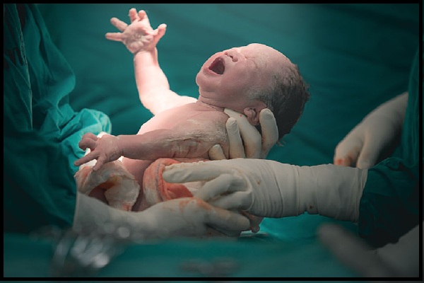 Normal Vaginal Delivery