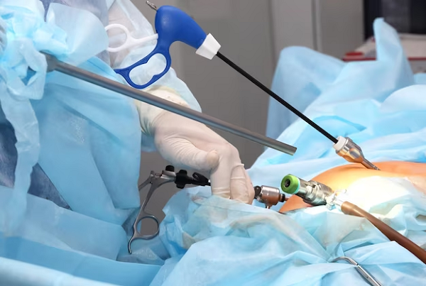 Laparoscopic Gynecological Surgery